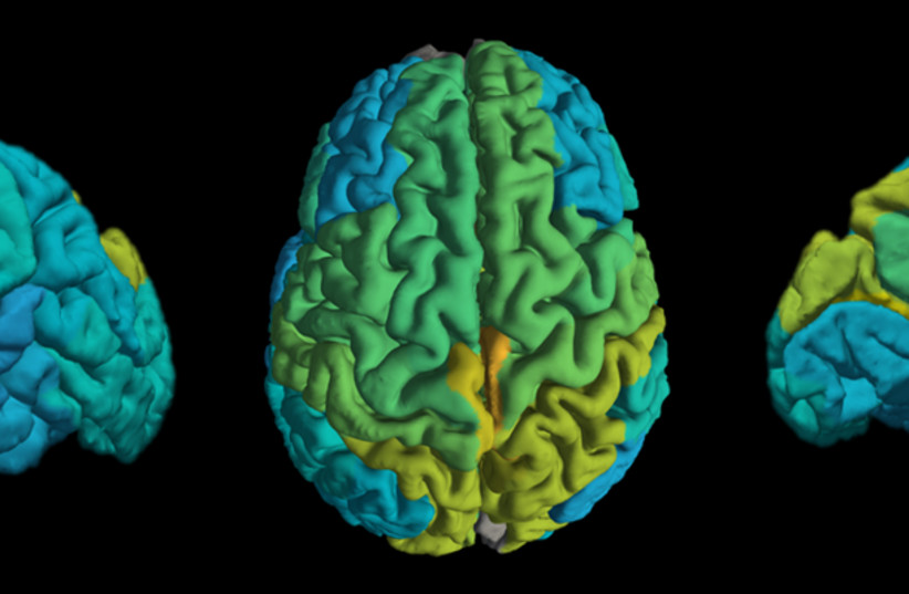 The new MRI Technique provides users with a molecular map of different areas in the brain (photo credit: SHIR FILO/HEBREW UNIVERSITY)