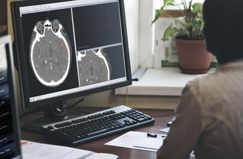 Aidocs AIaidoc technology being used during a CTA brain scan. (photo credit: AIDOC)
