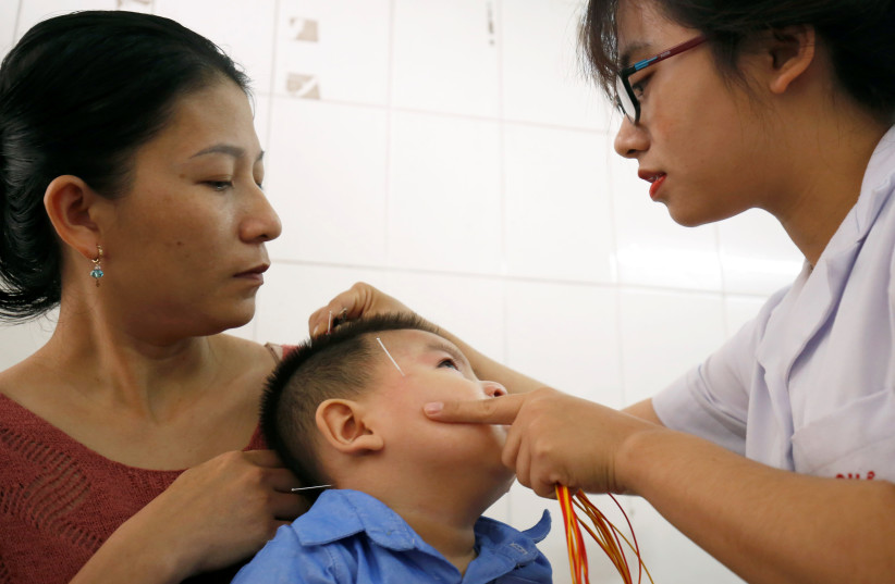 15-month-old Do Quang Tu who suffers from cerebral palsy, receives acupuncture treatment at Vietnam Acupuncture Hospital in Hanoi (photo credit: REUTERS)