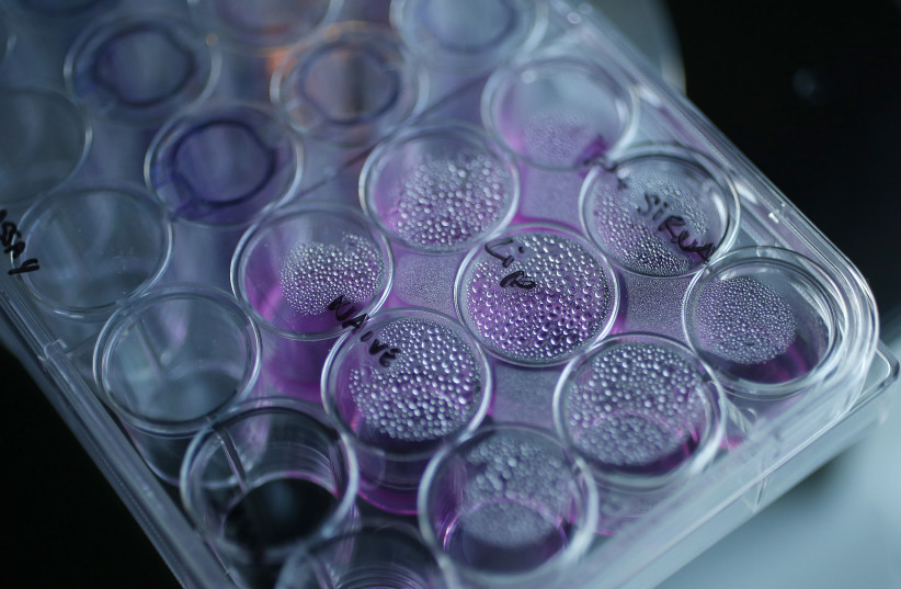 A tray containing cancer cells sits on an optical microscope in the Nanomedicine Lab at UCL's School of Pharmacy in London May 2, 2013. (photo credit: REUTERS/SUZANNE PLUNKETT)