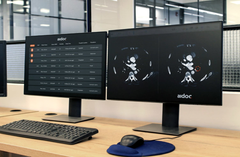 Aidoc's AI product is seen analyzing a CT scan. (credit: AIDOC)