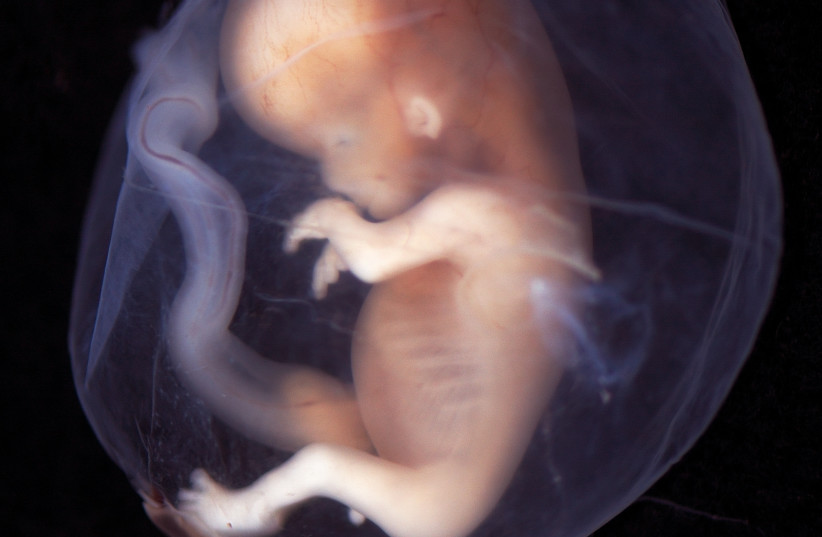 Embryo seen on week 9-10 (photo credit: Wikimedia Commons)