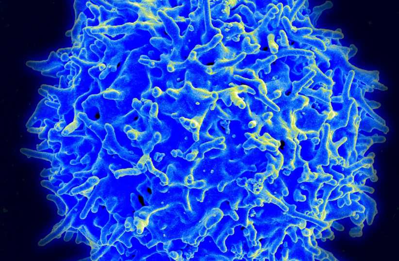 A healthy human T cell. (photo credit: Wikimedia Commons)