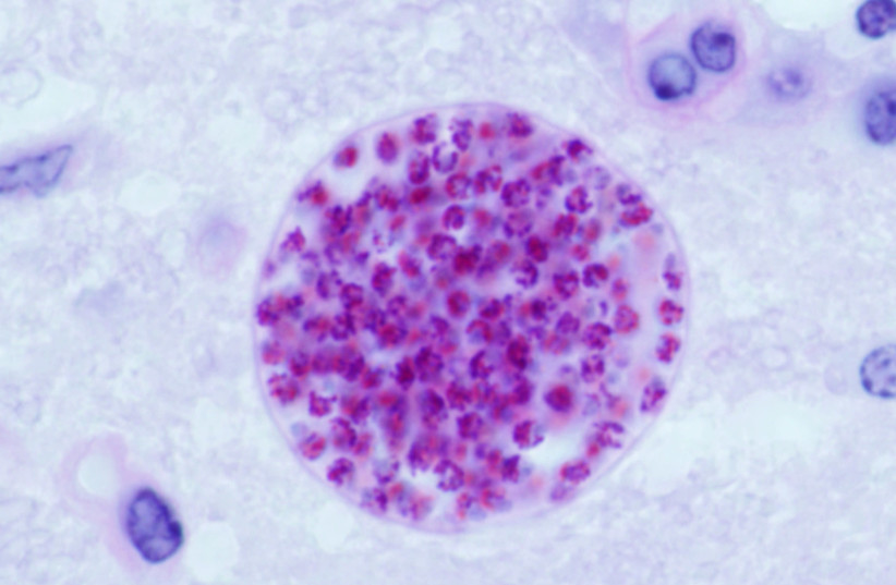 Toxoplasma gondii tissue is seen in a cyst in a mouse brain. (photo credit: Wikimedia Commons)