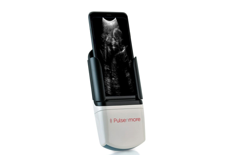 Israeli startup PulseNmore's at-home ultrasound machine (photo credit: PUBLIC DOMAIN)