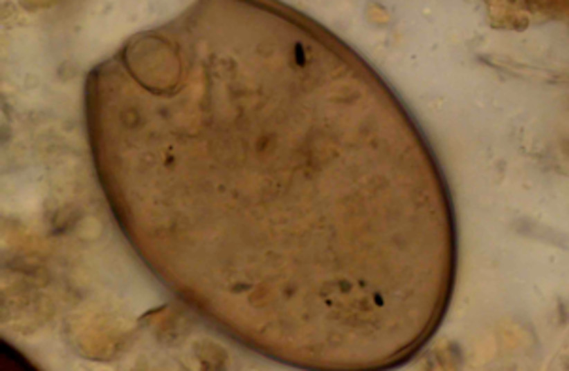 A microscopic fish tapeworm egg found in the medieval latrine at Riga. (photo credit: IVY YEH)