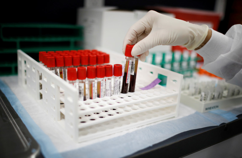 Test tubes, taken by a health care worker, with plasma and blood samples after a separation process in a centrifuge during a coronavirus vaccination study at the Research Centers of America, in Hollywood, Florida, US, September 24, 2020. (photo credit: REUTERS/MARCO BELLO)