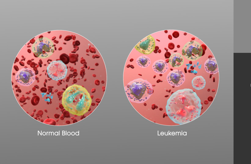  3D Medical Animation still showing an increase in white blood cells of a person suffering from Leukemia. (credit: WIKIMEDIA COMMONS/MANU SHARMA/WWW.SCIENTIFICANIMATIONS.COM)