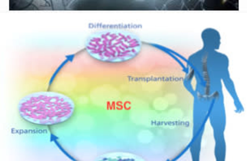 How does a new stem cell treatment help multiple sclerosis patients walk again? (credit: HADASSAH UNIVERSITY MEDICAL CENTER)