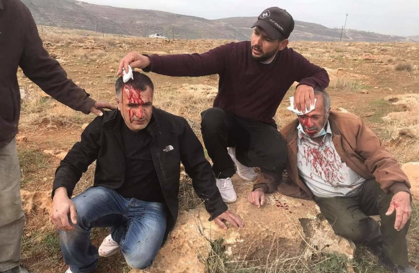 Palestinian farmer and son injured in territorial dispute (photo credit: AQRABA RESIDENT)