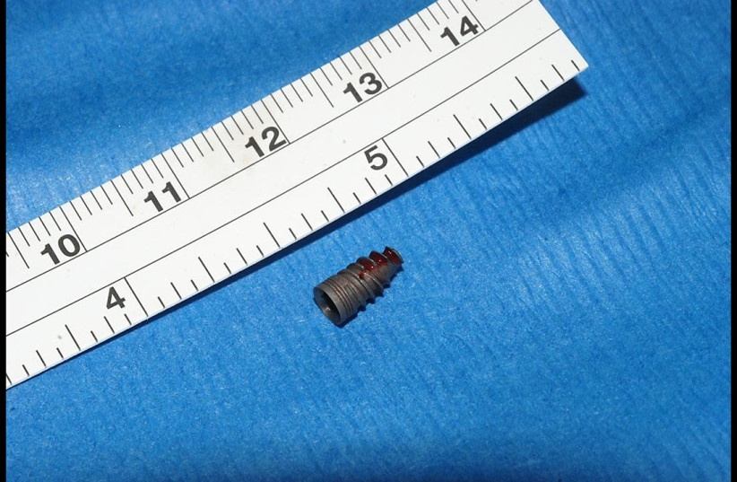 A picture of the dental implant found by  Hadassah Medical Center the  (photo credit: Courtesy)