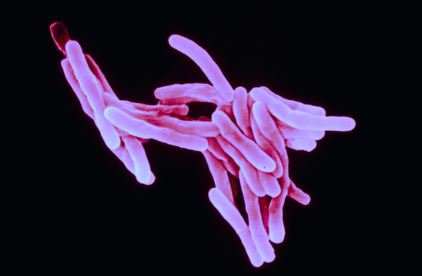 Tuberculosis. (photo credit: ALAIN GRILLET/FLICKR)