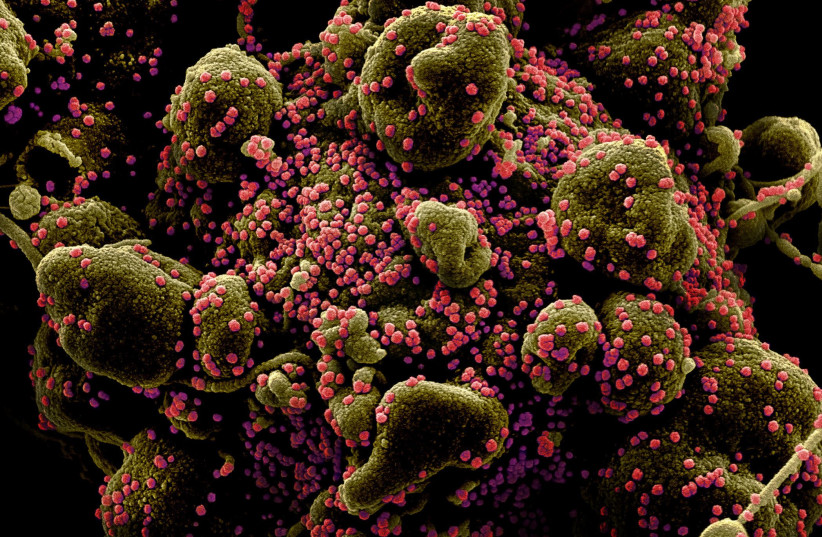 Colorized scanning electron micrograph of an apoptotic cell (greenish brown) heavily infected with SARS-COV-2 virus particles (pink), also known as novel coronavirus, isolated from a patient sample. Image captured and color-enhanced at the NIAID Integrated Research Facility (IRF) in Fort Detrick, Ma (credit: NATIONAL INSTITUTE OF ALLERGY AND INFECTIOUS DISEASES - NIH/HANDOUT VIA REUTERS)