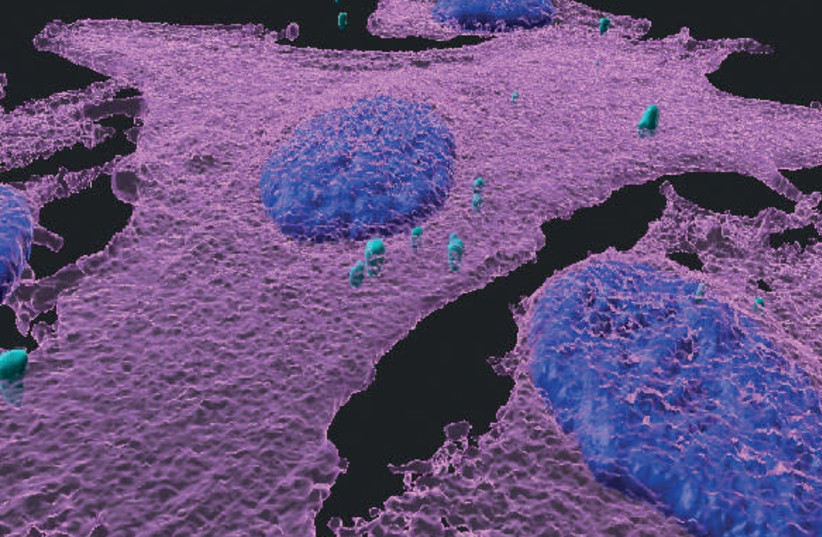 A 3D immunofluorescent image of melanoma cells (magenta) infected with bacteria (turquoise); cell nuclei are blue (credit: WEIZMANN INSTITUTE OF SCIENCE)