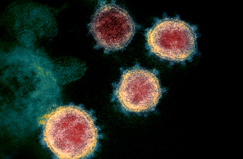 Ця векторна електронна мікрофотографія SARS-CoV-2, також відома як новий коронавірус, вірус, що викликає COVID-19, ізольований від пацієнта в США, показує частинки вірусу, що виходять з поверхні клітин, вирощених у лабораторії.  Нерівності на зовнішньому краї вірусу (кредит: NIAID-RML/ФАЙЛ ФОТО/ВИРОБНИК ВІД РЕЙТЕРІВ)