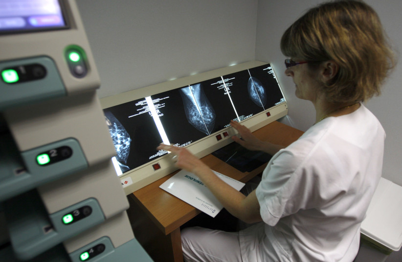 A radiologist examines breast X-rays after a cancer prevention medical check-up at the Ambroise Pare hospital in Marseille (credit: JEAN-PAUL PELISSIER / REUTERS)