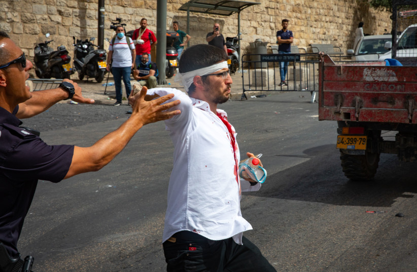 An injured jewish man seen after his car crashed when a mob pelted his car with stones outside Jerusalem's Old City, May 10, 2021. (credit: OLIVIER FITOUSSI/FLASH90)