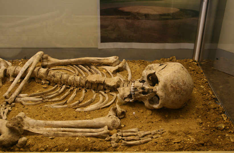  Illustrative photo of a skeleton (credit: David Pearson)
