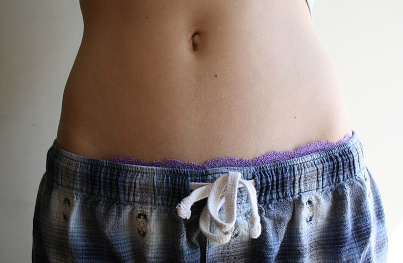  Navel of a woman (credit: Wikimedia Commons)