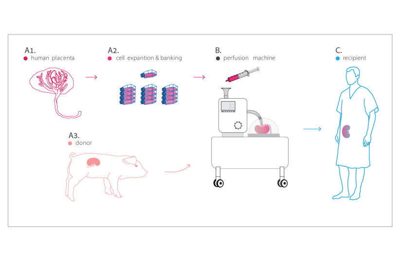 A diagram illustrates how pig organs can be used for human organ transplants. (credit: COURTESY OF NAYACURE LABS)