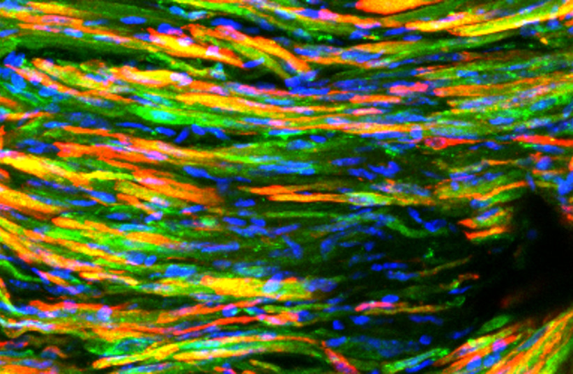  The implanted construct: the engineered muscle fibers (in red) express the GLUT4 (in green) (photo credit: TECHNION SPOKESPERSON'S OFFICE)