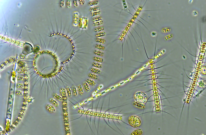 A collection of phytoplankton. (credit: Wikimedia Commons)