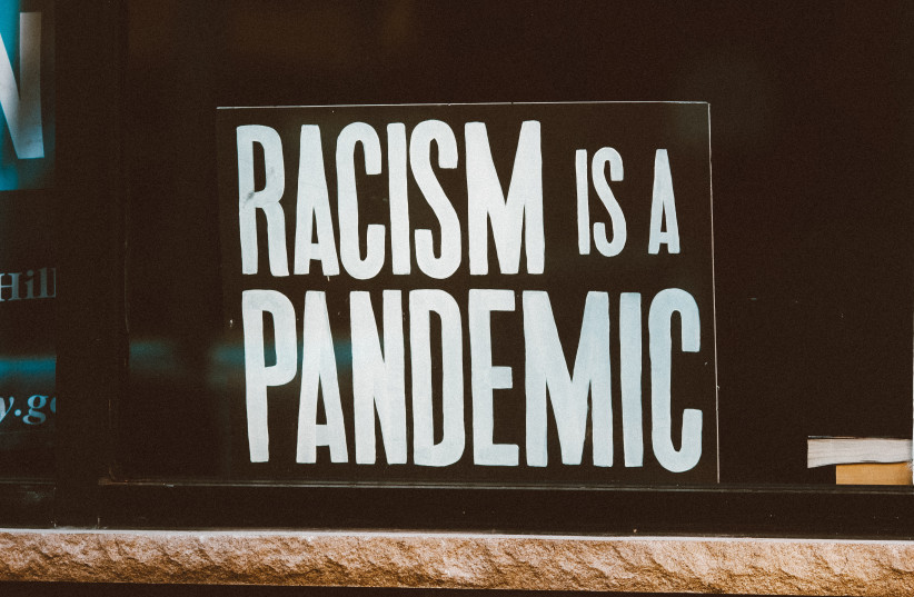  To be white these days “is a kind of slander.” (photo credit: JON TYSON/UNSPLASH)