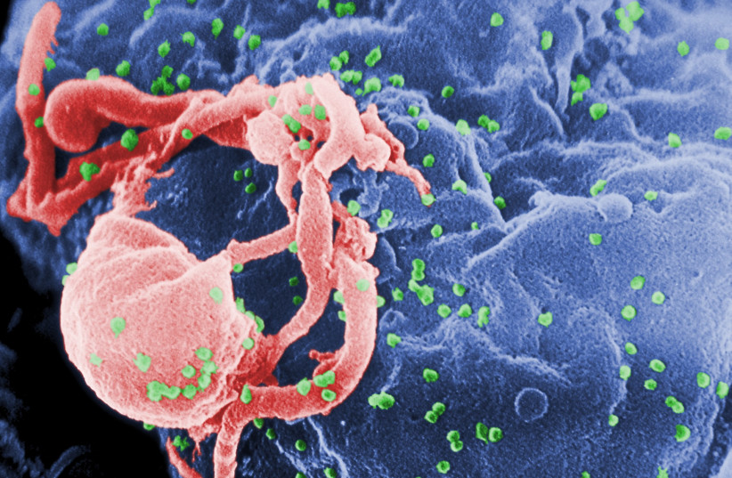  Scanning electron micrograph of HIV-1 budding (in green) from cultured lymphocyte. (photo credit: VIA WIKIMEDIA COMMONS)