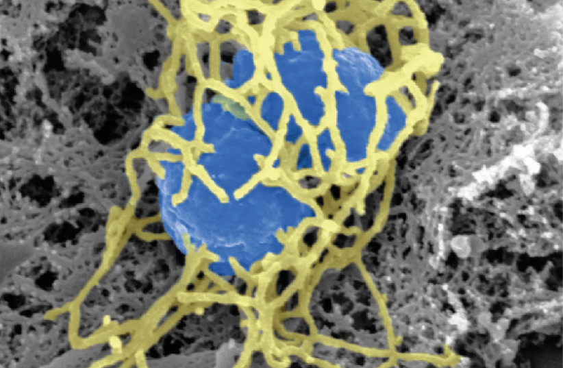  Scanning electron micrograph of a single N. meningitidis cell (colorized in blue) with its dense meshwork of pili (colorized in yellow) (photo credit: Arthur Charles-Orszag/Wikimedia Commons)