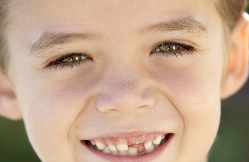  Kid with missing teeth (credit: INGIMAGE)