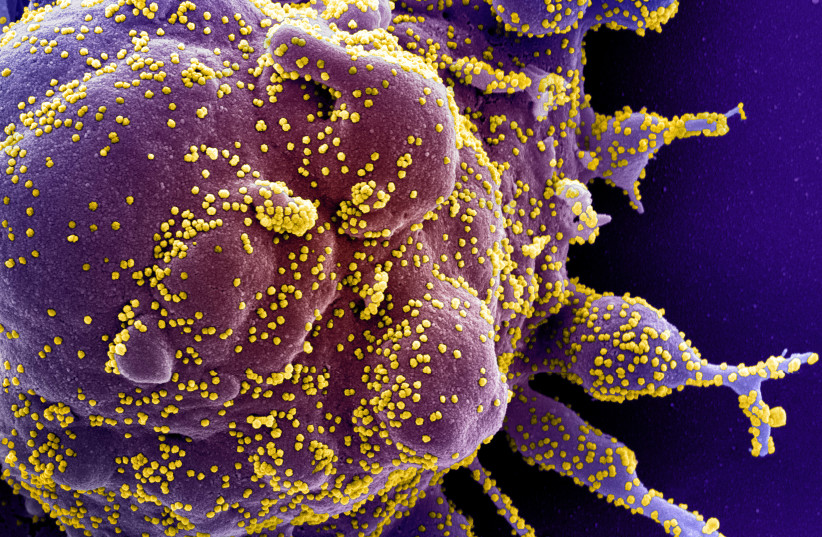 Colorized scanning electron micrograph of an apoptotic cell (purple) infected with SARS-COV-2 virus particles (yellow), also known as novel coronavirus, isolated from a patient sample. (credit: NIH/HANDOUT VIA REUTERS)