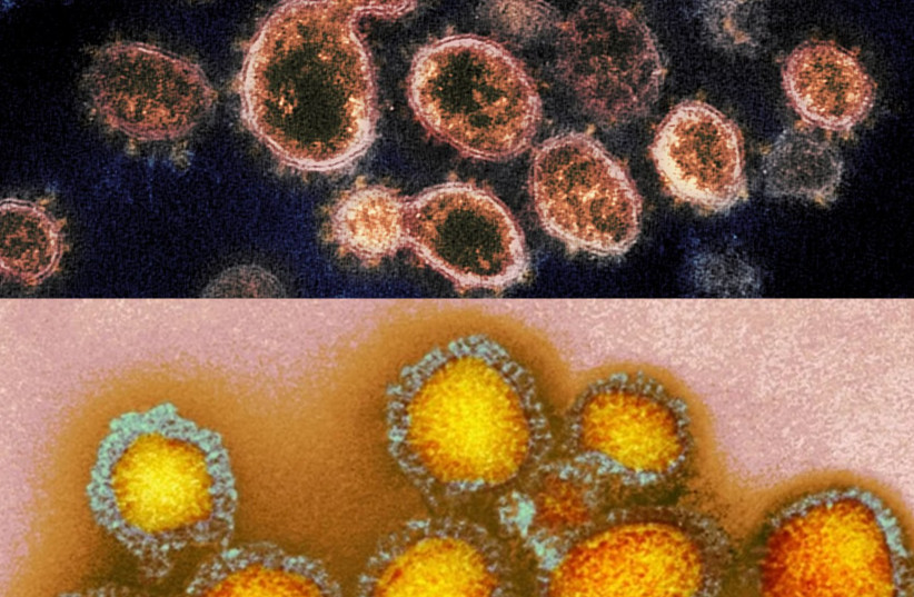 The novel coronavirus (top) and influenza (bottom) viruses are seen in this composite image. (credit: Wikimedia Commons)