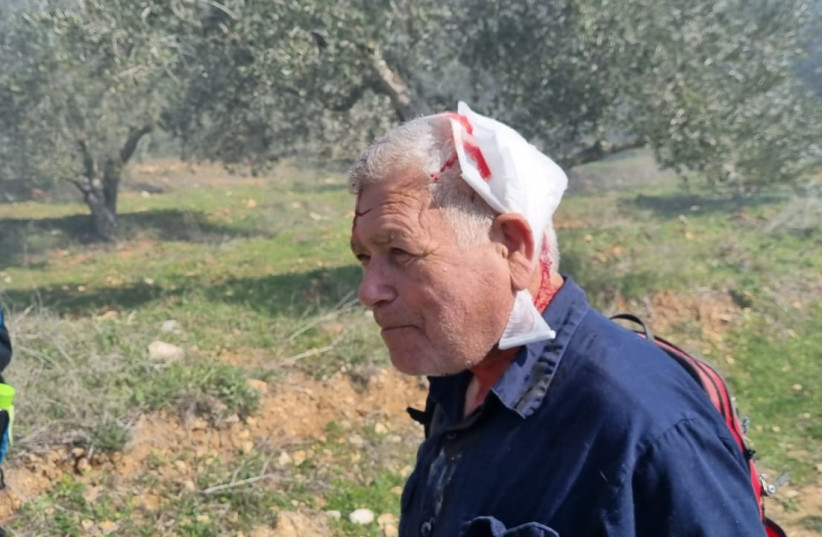  A man is seen wounded after being attacked by Jewish extremist settlers in the West Bank. (photo credit: YESH DIN)