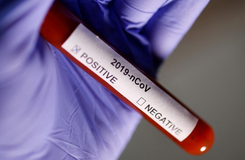 Test tube with Coronavirus label is seen in this illustration taken on January 29, 2020. (photo credit: REUTERS/DADO RUVIC/FILE PHOTO)