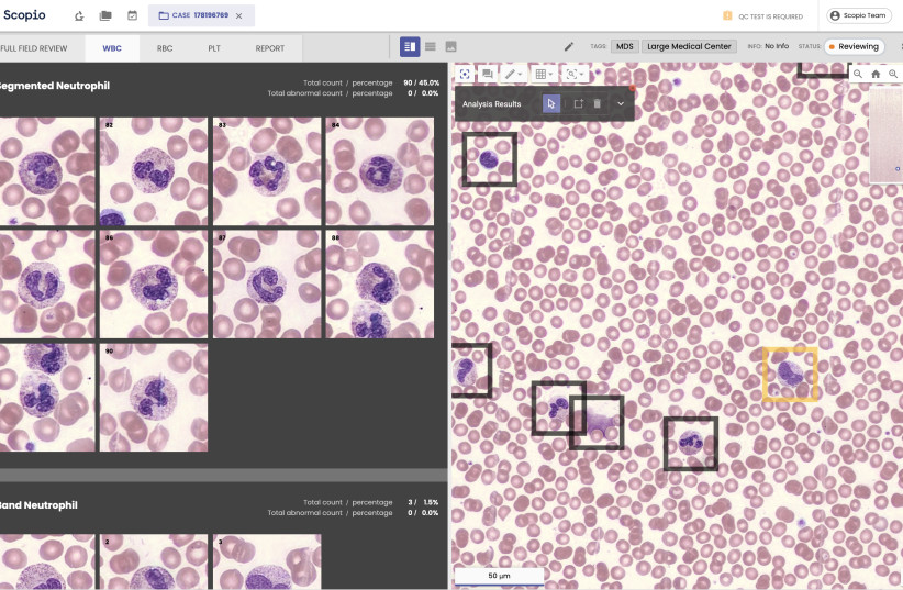   Scopio Labs' blood review platform in action. (credit: Scopio Labs)