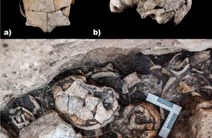  5,300-year-old skull under study found at El Pendón burial site. Top: Front and side view of the skull  Bottom:: Skull with ear surgery procedure in location it was found in the multi-phase tomb. (photo credit: ÑFotógrafos Photography Study)