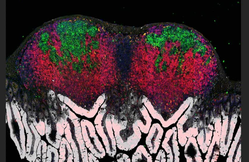   The inner lining of a mouse gut has finger-like projections (white) and harbors lymphatic organs (red) containing germinal centers (green). Viewed with confocal microscopy (photo credit: WEIZMANN INSTITUTE OF SCIENCE)