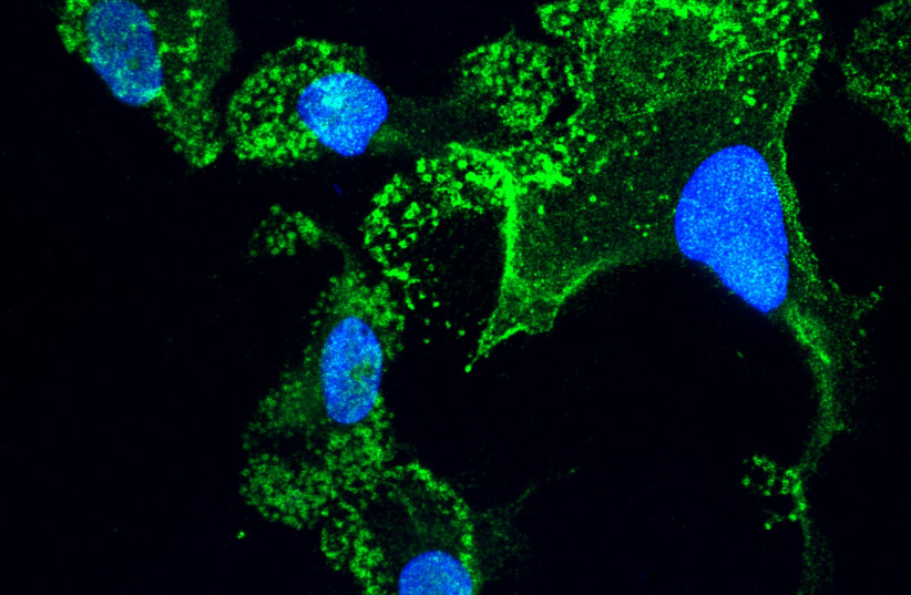  Microglia (green) that were “matured” in the lab from stem cells of ALS patients; the cells’ nuclei are in blue. Viewed with confocal microscopy (photo credit: WEIZMANN INSTITUTE OF SCIENCE)