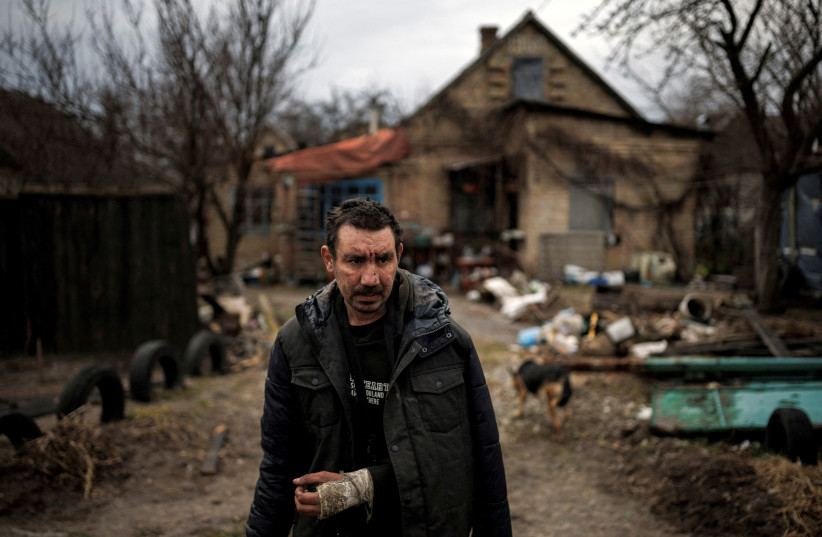 A man, who says Russian soldiers broke his arm, stands outside his house, amid Russia's invasion of Ukraine, in Bucha, in Kyiv region, Ukraine, April 6, 2022. (photo credit: REUTERS/ALKIS KONSTANTINIDIS)