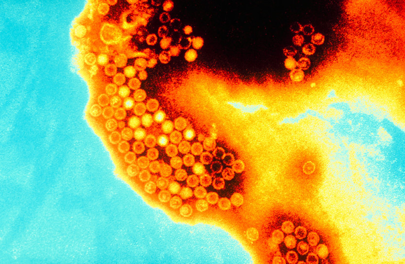 Hepatitis A virus (HVA) causes acute inflammation of the liver and is the most common of all forms of viral hepatitis (photo credit: ALAIN GRILLET/FLICKR)
