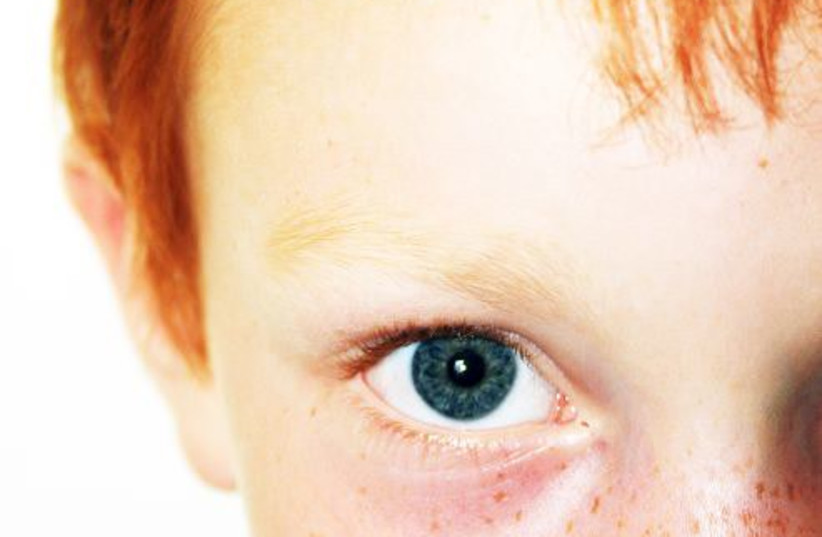  Boy with red hair and freckles. (credit: FLICKR)
