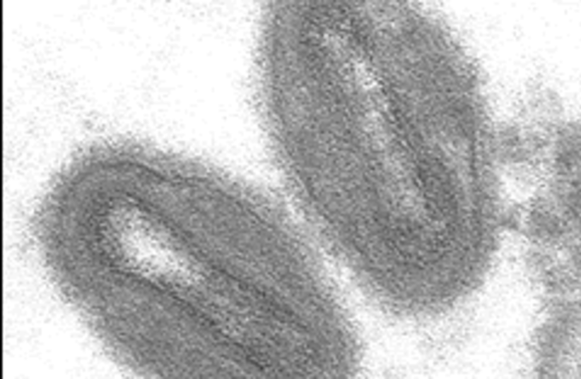 Electron micrograph of monkeypox virus (credit: NO AUTHOR SPECIFIED/PUBLIC DOMAIN/VIA WIKIMEDIA COMMONS)