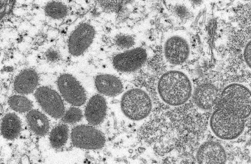  An electron microscopic (EM) image shows mature, oval-shaped monkeypox virus particles as well as crescents and spherical particles of immature virions, obtained from a clinical human skin sample associated with the 2003 prairie dog outbreak in this undated image obtained by Reuters on May 18, 2022 (photo credit: CYNTHIA S. GOLDSMITH, RUSSELL REGENCY/CDC/HANDOUT VIA REUTERS)