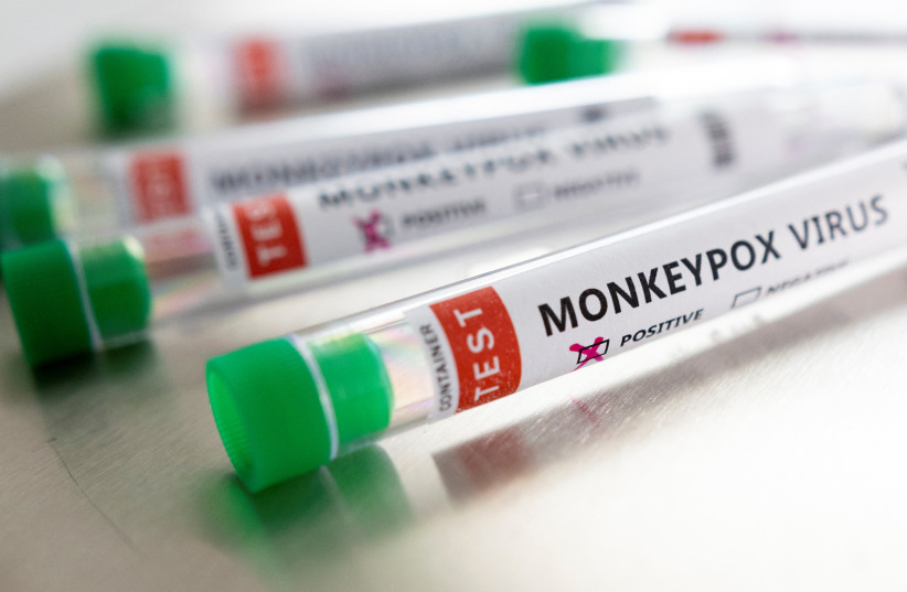  Test tubes labelled "Monkeypox virus positive" are seen in this illustration taken May 22, 2022.  (photo credit: REUTERS/DADO RUVIC/ILLUSTRATION)