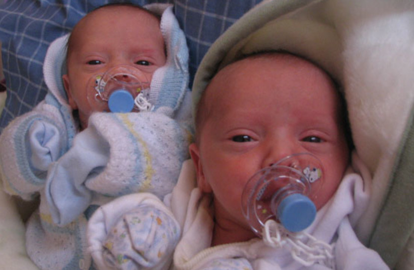  monozygotic twins (photo credit: Felipepuntocl/Wikimedia)