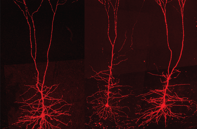  Three pyramidal nerve cells in the motor cortex, whose job it is to send the motor commands directly to the spinal cord. The cells are characterized by a pyramidal shape of the cell bodies and highly branched dendritic trees, a feature that allows them to perform complex parallel processing. (photo credit: RESEARCH PAPER)