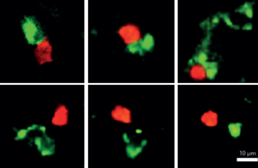  An Aire-ILC3 cell (green) "kisses" a Candida-fighting TH17 cell (red), telling it to start dividing (top row), but it ignores other T cells that do not specialize in fighting Candida (bottom row).  (photo credit: WEIZMANN INSTITUTE OF SCIENCE)