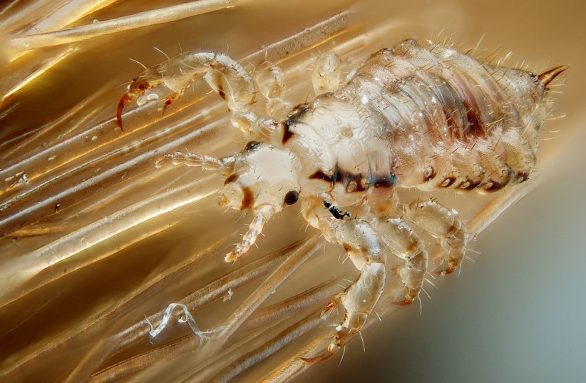  Male human head louse (credit: Wikimedia Commons)