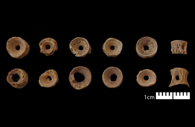  Small fish vertebrae have been modified to create beads that could be used for prayer. They were found clustered around the neck of a skeleton, which are thought to be the remains of a monk or other person associated with the early monastery (credit: DIGVENTURES)