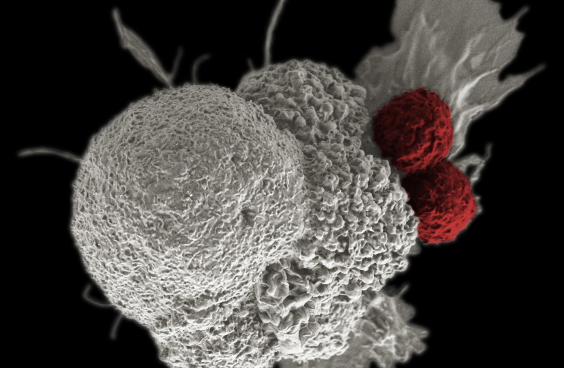  Cancer Immunotherapy by  NIH Image Gallery. (credit: FLICKR)